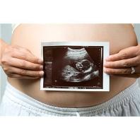 pregnant woman with photo of fetus