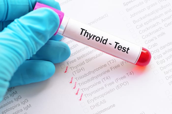 thyroid test tube